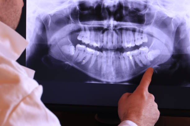Best Dentist for Tooth Abscess  in Palm River Clair Mel, FL